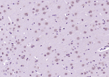 Phospho-AKT3 (Ser472) Rabbit Polyclonal Antibody