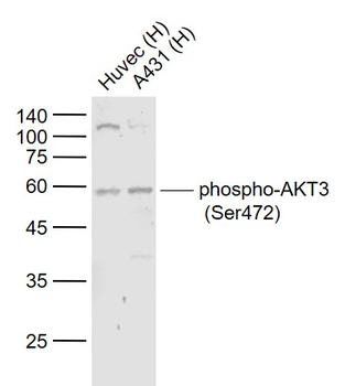 Phospho-AKT3 (Ser472) Rabbit Polyclonal Antibody