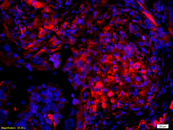 Phospho-AKT3 (Ser472) Rabbit Polyclonal Antibody