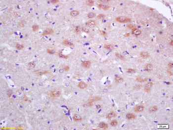 Peroxiredoxin 1 Rabbit Polyclonal Antibody