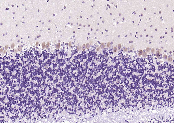 Phospho-PSD95 (Tyr236 + Tyr240) Rabbit Polyclonal Antibody