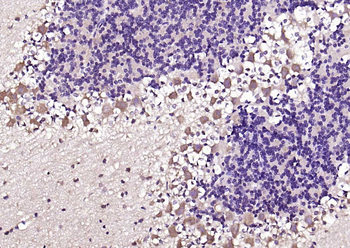 Phospho-PSD95 (Tyr236 + Tyr240) Rabbit Polyclonal Antibody