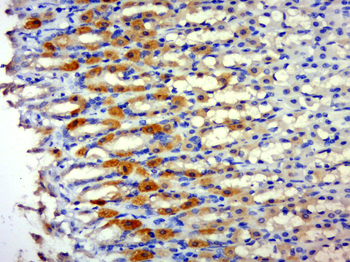 Phospho-PSD95 (Tyr236 + Tyr240) Rabbit Polyclonal Antibody