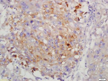 PSMB8 Rabbit Polyclonal Antibody