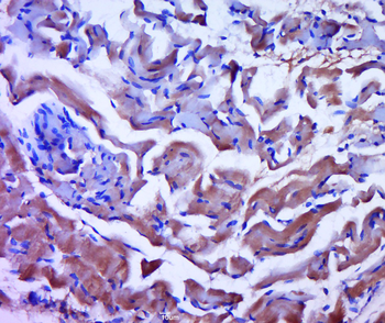 PYGM Rabbit Polyclonal Antibody