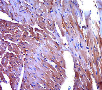 PYGM Rabbit Polyclonal Antibody