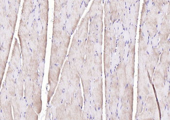 PYGM Rabbit Polyclonal Antibody