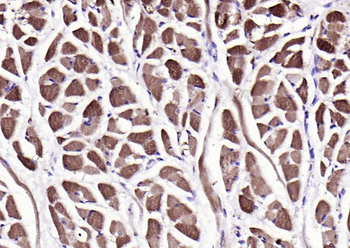 PYGM Rabbit Polyclonal Antibody