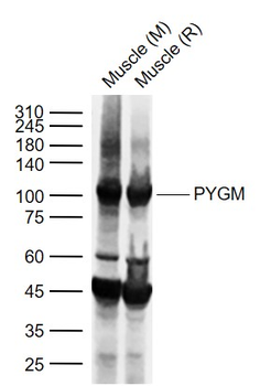 PYGM Rabbit Polyclonal Antibody