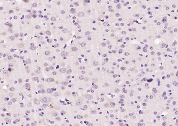 RASGRF1 Rabbit Polyclonal Antibody