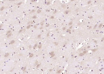 Phospho-RASGRF1 (Ser929) Rabbit Polyclonal Antibody