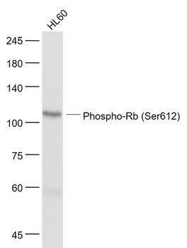 Phospho-Rb (Ser612) Rabbit Polyclonal Antibody