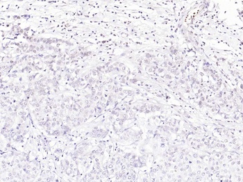 Rb (phospho-Ser612) antibody