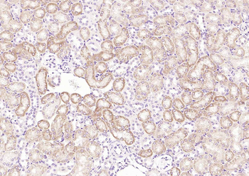 RelB Rabbit Polyclonal Antibody