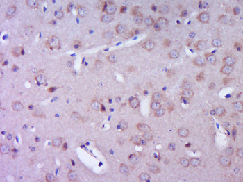 RIP2 Rabbit Polyclonal Antibody