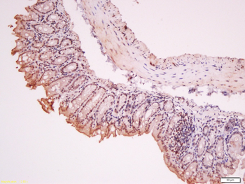 RORC Rabbit Polyclonal Antibody