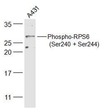 Phospho-RPS6 (Ser240 + Ser244) Rabbit Polyclonal Antibody
