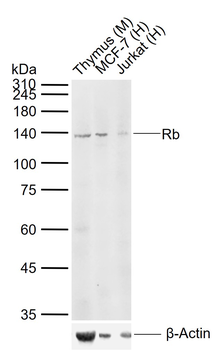 Rb Rabbit Polyclonal Antibody