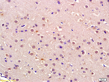 Rb Rabbit Polyclonal Antibody
