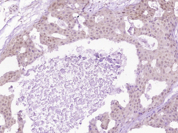 S100A4 Rabbit Polyclonal Antibody