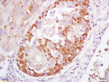 S100A4 Rabbit Polyclonal Antibody