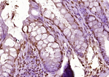 CTDSPL Rabbit Polyclonal Antibody