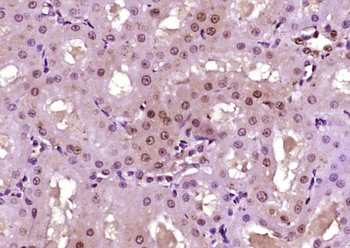 CTDSPL Rabbit Polyclonal Antibody