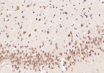 Phospho-SGK1 (Ser78) Rabbit Polyclonal Antibody