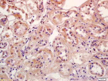 Phospho-SGK1 (Ser78) Rabbit Polyclonal Antibody