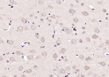 MEG1 Rabbit Polyclonal Antibody