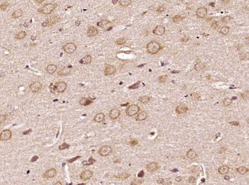 SIAH1 Rabbit Polyclonal Antibody