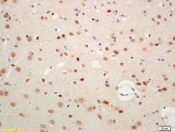 SIAH1 Rabbit Polyclonal Antibody
