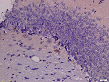 MCT4/SLC16A3 Rabbit Polyclonal Antibody