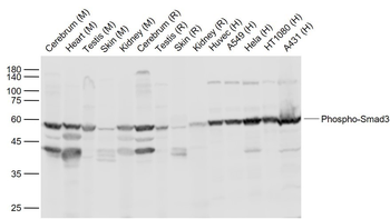 Phospho-Smad1/5 (Ser463 + Ser465) Rabbit Polyclonal Antibody