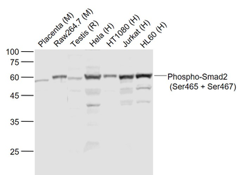 Phospho-Smad2 (Ser465 + Ser467) Rabbit Polyclonal Antibody
