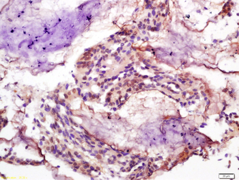 Phospho-Smad3 (Ser425) Rabbit Polyclonal Antibody