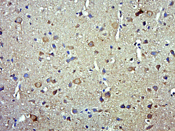 Phospho-Smad3 (Ser208) Rabbit Polyclonal Antibody