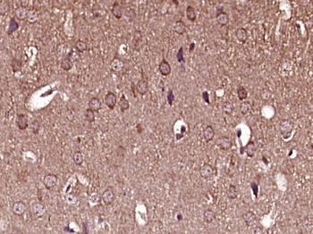 Phospho-MYPT1 (Ser507) Rabbit Polyclonal Antibody