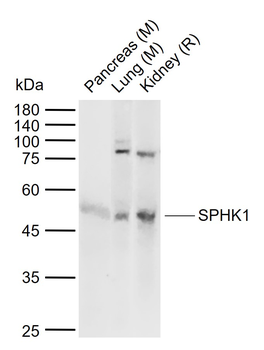 SPHK1 Rabbit Polyclonal Antibody