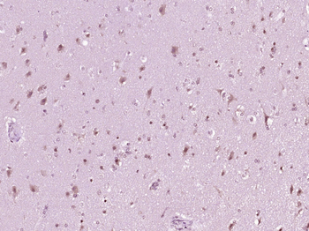 Phospho-NCOA3 (Thr24) Rabbit Polyclonal Antibody