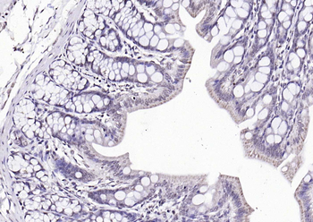 Phospho-Src (Tyr418) Rabbit Polyclonal Antibody