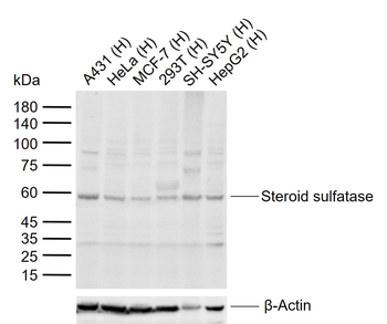 Steroid sulfatase Rabbit Polyclonal Antibody