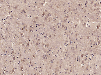 Phospho-STAT3 (Ser727) Rabbit Polyclonal Antibody