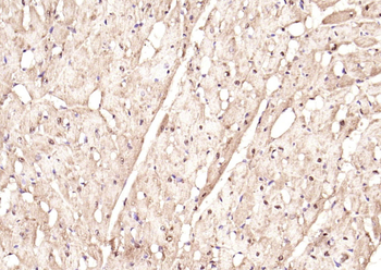 Phospho-STAT3 (Ser727) Rabbit Polyclonal Antibody