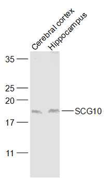 STMN2 Rabbit Polyclonal Antibody