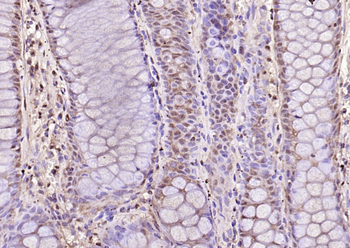 HMGB1 Rabbit Polyclonal Antibody
