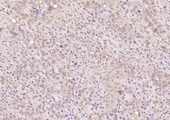 HMGB1 Rabbit Polyclonal Antibody