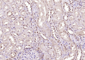 HMGB1 Rabbit Polyclonal Antibody
