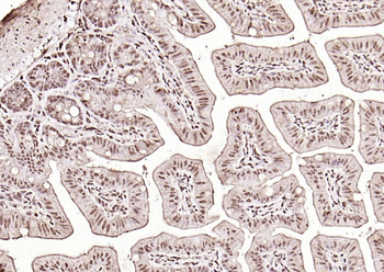 HMGB1 Rabbit Polyclonal Antibody