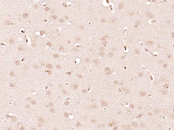 Alpha Synuclein (phospho-Ser129) antibody